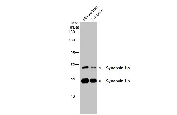 Various tissue extracts (50 μg) were separated by 7.5% SDS-PAGE, and the membrane was blotted with Synapsin II antibody [GT387] (GTX635883) diluted at 1:1000. The HRP-conjugated anti-mouse IgG antibody (GTX213111-01) was used to detect the primary antibody.