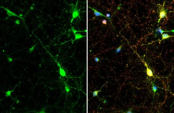 Synapsin II antibody [GT387] detects Synapsin II protein at synapse by immunofluorescent analysis. Sample: DIV10 rat E18 primary cortical neuron cells were fixed in 4% paraformaldehyde at RT for 15 min. Green: Synapsin II stained by Synapsin II antibody [GT387] (GTX635883) diluted at 1:500. Red: Tau, an axon marker, stained by Tau antibody (GTX130462) diluted at 1:500.