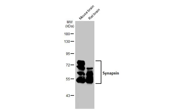 Various tissue extracts (50 μg) were separated by 7.5% SDS-PAGE, and the membrane was blotted with Synapsin antibody [GT965] (GTX635885) diluted at 1:1000. The HRP-conjugated anti-mouse IgG antibody (GTX213111-01) was used to detect the primary antibody.