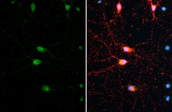 Synapsin antibody [GT965] detects Synapsin protein at synapse by immunofluorescent analysis. Sample: DIV10 rat E18 primary cortical neuron cells were fixed in 4% paraformaldehyde at RT for 15 min. Green: Synapsin stained by Synapsin antibody [GT965] (GTX635885) diluted at 1:500. Red: Tau, an axon marker, stained by Tau antibody (GTX130462) diluted at 1:500.