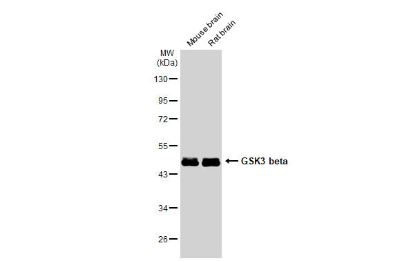 Various tissue extracts (50 microg) were separated by 10% SDS-PAGE, and the membrane was blotted with GSK3 beta antibody [GT1619] (GTX635886) diluted at 1:10000. The HRP-conjugated anti-mouse IgG antibody (GTX213111-01) was used to detect the primary antibody.