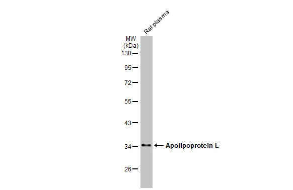 Rat plasma (50 μg) was separated by 10% SDS-PAGE, and the membrane was blotted with Apolipoprotein E antibody [GT27711] (GTX635889) diluted at 1:25000. The HRP-conjugated anti-mouse IgG antibody (GTX213111-01) was used to detect the primary antibody.