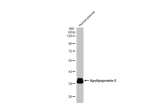 Human plasma (30 μg) was separated by 10% SDS-PAGE, and the membrane was blotted with Apolipoprotein E antibody [GT27711] (GTX635889) diluted at 1:25000. The HRP-conjugated anti-mouse IgG antibody (GTX213111-01) was used to detect the primary antibody.