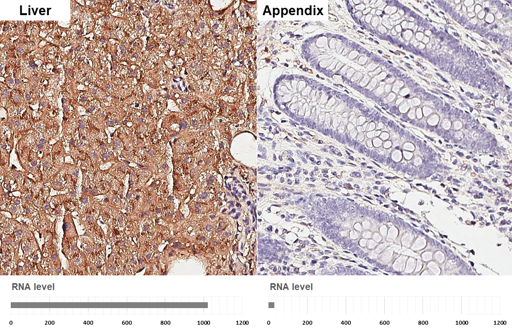 Apolipoprotein E antibody [GT27711] detects Apolipoprotein E protein by immunohistochemical analysis. Sample: Paraffin-embedded human tissues. Apolipoprotein E stained by Apolipoprotein E antibody [GT27711] (GTX635889) diluted at 1:200. Antigen Retrieval: Citrate buffer, pH 6.0, 15 min