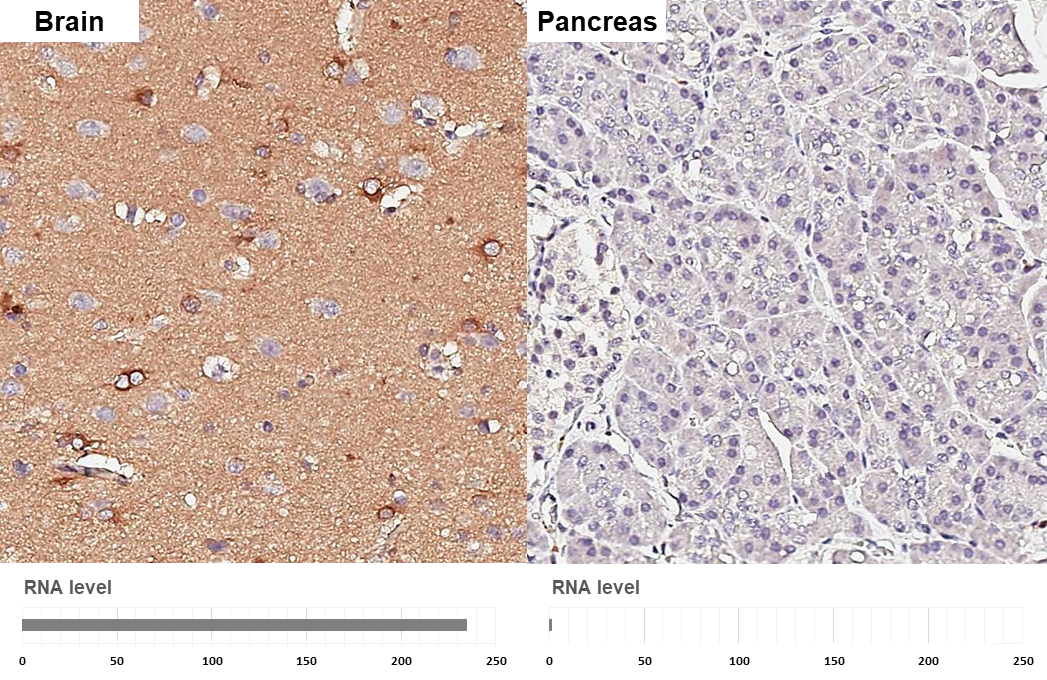 Apolipoprotein E antibody [GT27711] detects Apolipoprotein E protein by immunohistochemical analysis. Sample: Paraffin-embedded human tissues. Apolipoprotein E stained by Apolipoprotein E antibody [GT27711] (GTX635889) diluted at 1:200. Antigen Retrieval: Citrate buffer, pH 6.0, 15 min