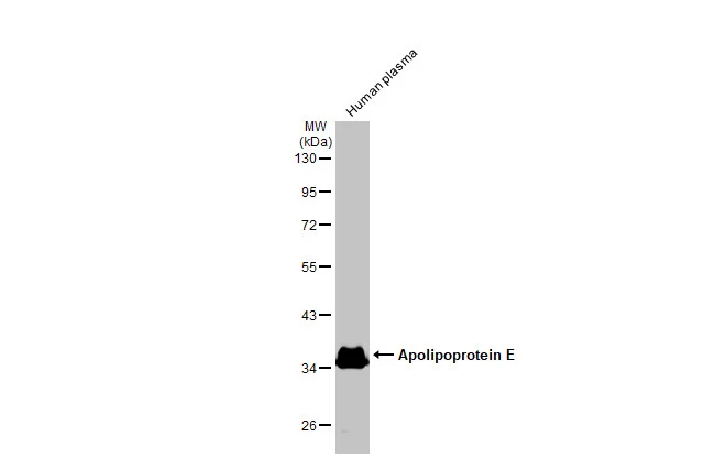 Apolipoprotein E antibody [GT1627]