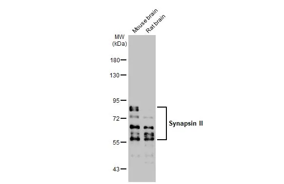 Various tissue extracts (50 μg) were separated by 7.5% SDS-PAGE, and the membrane was blotted with Synapsin II antibody [GT1446] (GTX635894) diluted at 1:10000. The HRP-conjugated anti-mouse IgG antibody (GTX213111-01) was used to detect the primary antibody.