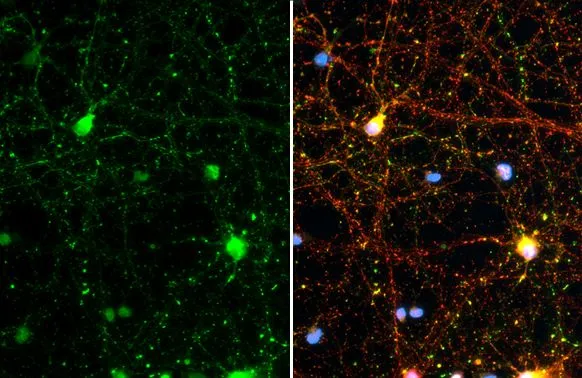 Synapsin II antibody [GT1446] detects Synapsin II protein at synapse by immunofluorescent analysis. Sample: DIV10 rat E18 primary cortical neuron cells were fixed in 4% paraformaldehyde at RT for 15 min. Green: Synapsin II stained by Synapsin II antibody [GT1446] (GTX635894) diluted at 1:500. Red: Tau, an axon marker, stained by Tau antibody (GTX130462) diluted at 1:500.