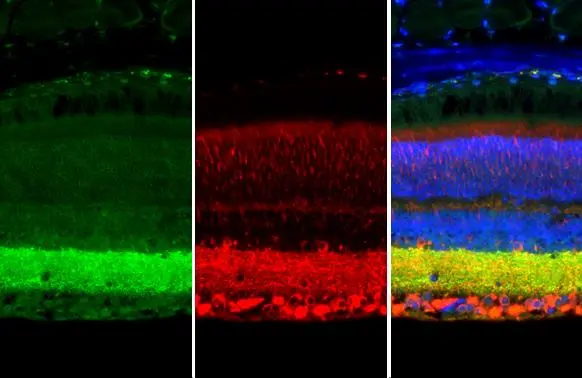 Synapsin II antibody [GT1446] detects Synapsin II protein at cell membrane and cytoplasm by immunohistochemical analysis. Sample: Paraffin-embedded mouse eye. Green: Synapsin II stained by Synapsin II antibody [GT1446] (GTX635894) diluted at 1:250. Red: beta Tubulin 3/ Tuj1, a cytoskeleton marker, stained by beta Tubulin 3/ Tuj1 antibody (GTX130245) diluted at 1:500. Blue: Fluoroshield with DAPI (GTX30920). Antigen Retrieval: Citrate buffer, pH 6.0, 15 min