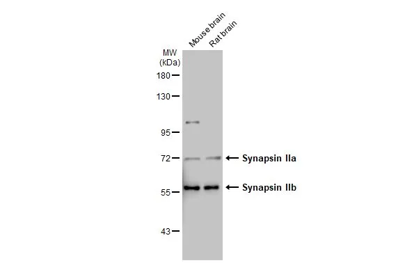 Various tissue extracts (50 μg) were separated by 7.5% SDS-PAGE, and the membrane was blotted with Synapsin II antibody [GT763] (GTX635896) diluted at 1:1000. The HRP-conjugated anti-mouse IgG antibody (GTX213111-01) was used to detect the primary antibody.