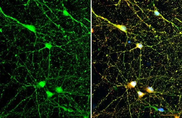Synapsin II antibody [GT763] detects Synapsin II protein at synapse by immunofluorescent analysis. Sample: DIV10 rat E18 primary cortical neuron cells were fixed in 4% paraformaldehyde at RT for 15 min. Green: Synapsin II stained by Synapsin II antibody [GT763] (GTX635896) diluted at 1:500. Red: Tau, an axon marker, stained by Tau antibody (GTX130462) diluted at 1:500.
