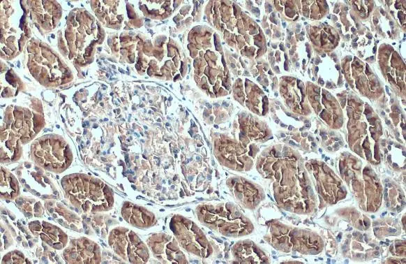 ACE2 antibody [GT19410] detects ACE2 protein at cell membrane and cytoplasm by immunohistochemical analysis. Sample: Paraffin-embedded human kidney. ACE2 stained by ACE2 antibody [GT19410] (GTX635897) diluted at 1:200. Antigen Retrieval: Citrate buffer, pH 6.0, 15 min