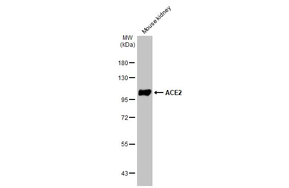 Mouse tissue extract (50 microg) was separated by 7.5% SDS-PAGE, and the membrane was blotted with ACE2 antibody [GT19410] (GTX635897) diluted at 1:1000. The HRP-conjugated anti-mouse IgG antibody (GTX213111-01) was used to detect the primary antibody.