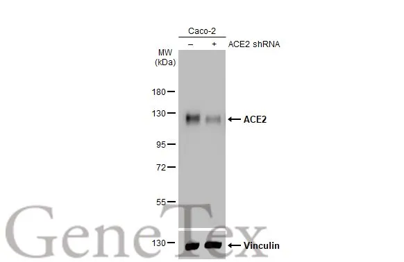 Non-transfected (-) and transfected (+) Caco-2 whole cell extracts (30 microg) were separated by 7.5% SDS-PAGE, and the membrane was blotted with ACE2 antibody [GT19410] (GTX635897) diluted at 1:1000. The HRP-conjugated anti-mouse IgG antibody (GTX213111-01) was used to detect the primary antibody.