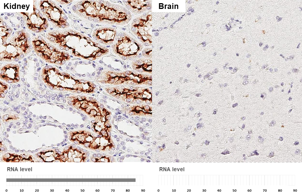 ACE2 antibody [GT19410] detects ACE2 protein by immunohistochemical analysis. Sample: Paraffin-embedded human tissues. ACE2 stained by ACE2 antibody [GT19410] (GTX635897) diluted at 1:800. Antigen Retrieval: Tris-EDTA buffer, pH 9.0, 15 min