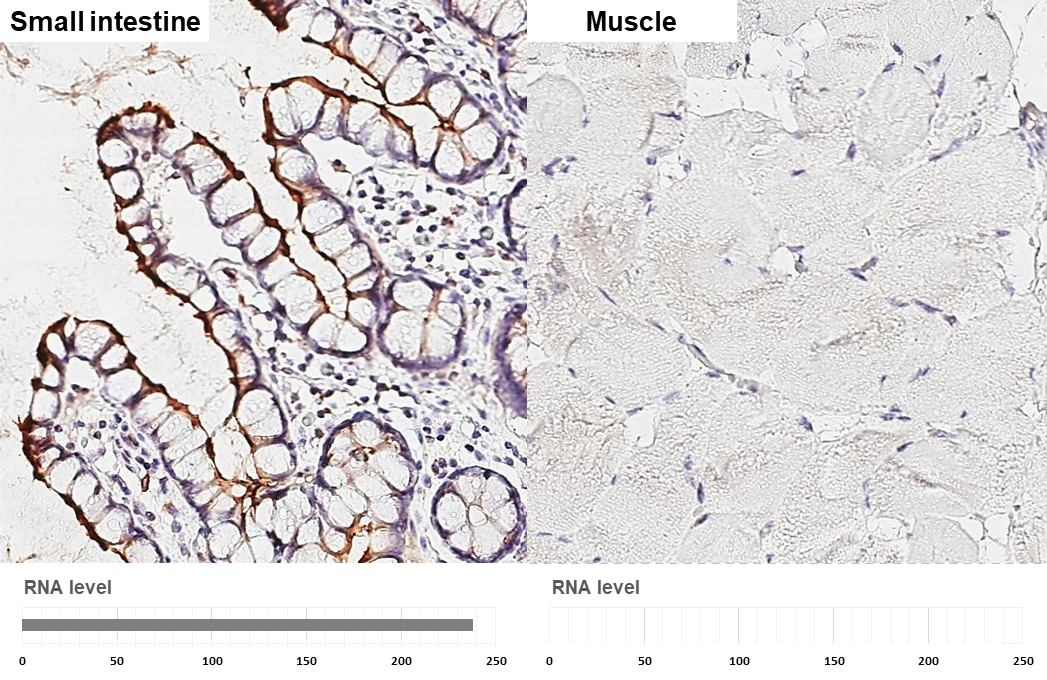 ACE2 antibody [GT19410] detects ACE2 protein by immunohistochemical analysis. Sample: Paraffin-embedded human tissues. ACE2 stained by ACE2 antibody [GT19410] (GTX635897) diluted at 1:800. Antigen Retrieval: Tris-EDTA buffer, pH 9.0, 15 min