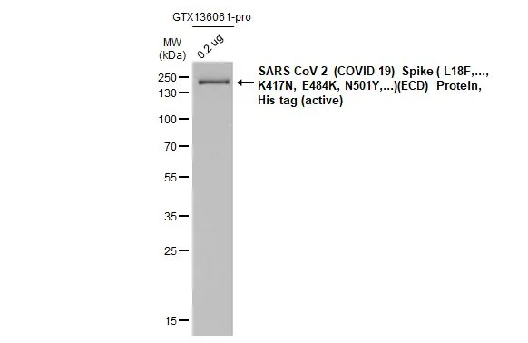 SARS-CoV-2 (COVID-19) Spike ( L18F,..., K417N, E484K, N501Y,...)(ECD) Protein, His tag (active) (GTX136061-pro, 0.2 microg) was separated by 12% SDS-PAGE, and the membrane was blotted with SARS-CoV-2 (COVID-19) Spike S2 / S2 antibody [HL1039] (GTX635911) diluted at 1:140000. The HRP-conjugated anti-rabbit IgG antibody (GTX213110-01) was used to detect the primary antibody.