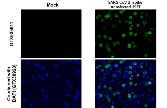 Anti-SARS-CoV-2 (COVID-19) Spike S2 / S2' antibody [HL1039