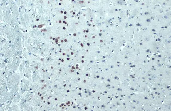 FOXP2 antibody [GT12812]