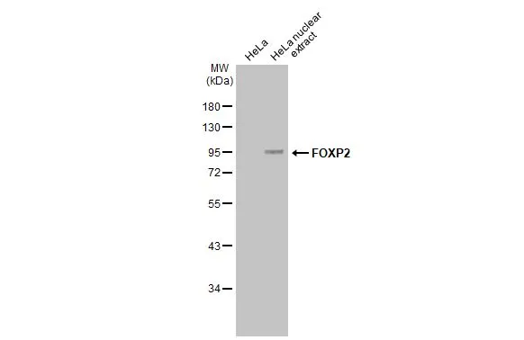 FOXP2 antibody [GT12812]