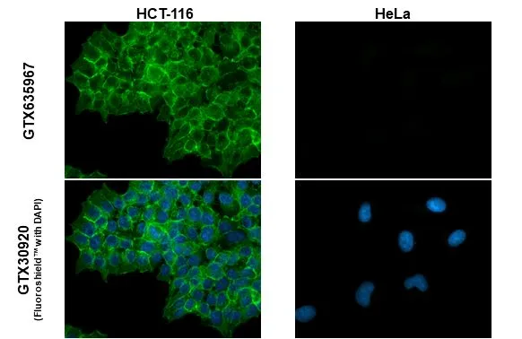 EpCAM antibody [GT25512] detects EpCAM protein at cell membrane by immunofluorescent analysis. Sample: HCT116 and HeLa cells were fixed in ice-cold MeOH for 5 min. Green: EpCAM stained by EpCAM antibody [GT25512] (GTX635967) diluted at 1:500.
