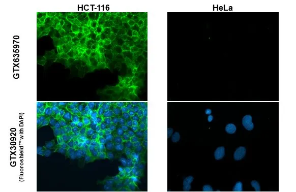 EpCAM antibody [GT3188] detects EpCAM protein at cell membrane by immunofluorescent analysis. Sample: HCT116 and HeLa cells were fixed in ice-cold MeOH for 5 min. Green: EpCAM stained by EpCAM antibody [GT3188] (GTX635970) diluted at 1:500.
