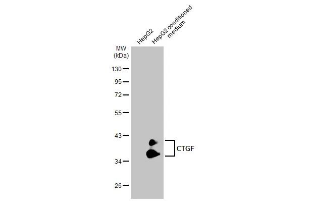 CTGF antibody [GT1116]