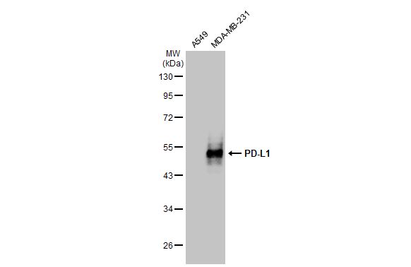 Various whole cell extracts (30 microg) were separated by 10% SDS-PAGE, and the membrane was blotted with PD-L1 antibody [HL1041] (GTX635975) diluted at 1:2000. The HRP-conjugated anti-rabbit IgG antibody (GTX213110-01) was used to detect the primary antibody.