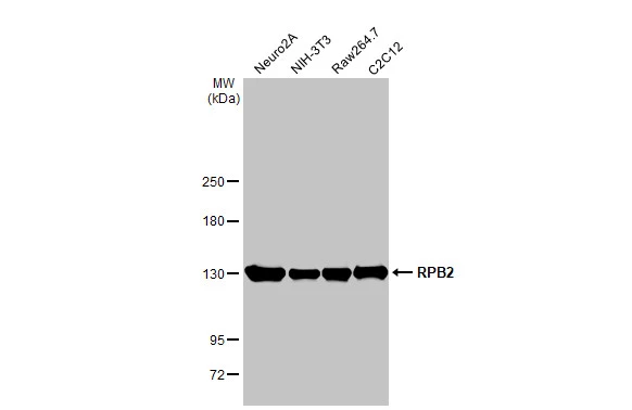 Various whole cell extracts (30 μg) were separated by 5% SDS-PAGE, and the membrane was blotted with RPB2 antibody [HL1042] (GTX635976) diluted at 1:1000. The HRP-conjugated anti-rabbit IgG antibody (GTX213110-01) was used to detect the primary antibody.