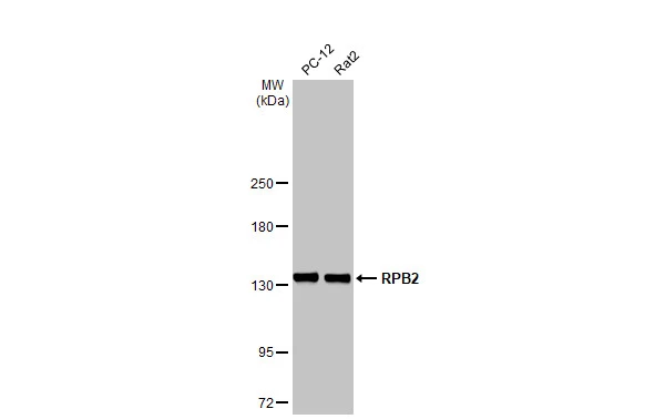 Various whole cell extracts (30 μg) were separated by 5% SDS-PAGE, and the membrane was blotted with RPB2 antibody [HL1042] (GTX635976) diluted at 1:5000. The HRP-conjugated anti-rabbit IgG antibody (GTX213110-01) was used to detect the primary antibody.