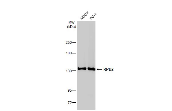 Various whole cell extracts (30 μg) were separated by 5% SDS-PAGE, and the membrane was blotted with RPB2 antibody [HL1042] (GTX635976) diluted at 1:1000. The HRP-conjugated anti-rabbit IgG antibody (GTX213110-01) was used to detect the primary antibody.