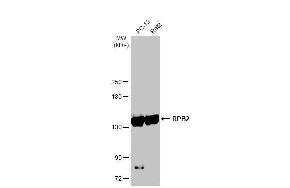 Various whole cell extracts (30 μg) were separated by 5% SDS-PAGE, and the membrane was blotted with RPB2 antibody [HL1043] (GTX635977) diluted at 1:1000. The HRP-conjugated anti-rabbit IgG antibody (GTX213110-01) was used to detect the primary antibody.