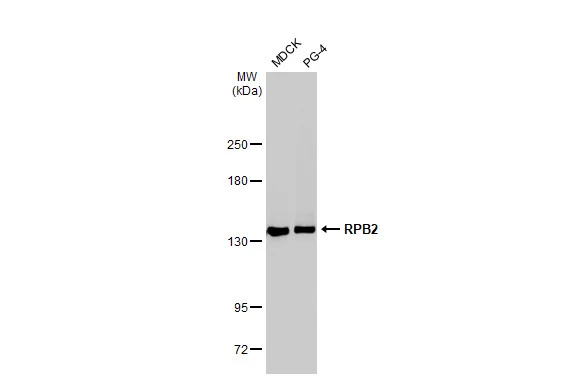 Various whole cell extracts (30 μg) were separated by 5% SDS-PAGE, and the membrane was blotted with RPB2 antibody [HL1043] (GTX635977) diluted at 1:1000. The HRP-conjugated anti-rabbit IgG antibody (GTX213110-01) was used to detect the primary antibody.