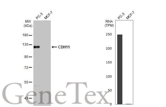 Various whole cell extracts (30 μg) were separated by 7.5% SDS-PAGE, and the membrane was blotted with CDH11 antibody [HL1044] (GTX635978) diluted at 1:1000. The HRP-conjugated anti-rabbit IgG antibody (GTX213110-01) was used to detect the primary antibody. Corresponding RNA expression data for the same cell lines are based on Human Protein Atlas program.