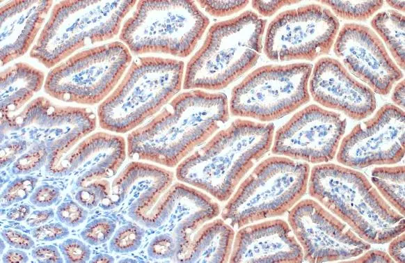 RAB6A antibody [HL1047] detects RAB6A protein at Golgi apparatus by immunohistochemical analysis. Sample: Paraffin-embedded mouse intestine. RAB6A stained by RAB6A antibody [HL1047] (GTX635981) diluted at 1:100. Antigen Retrieval: Citrate buffer, pH 6.0, 15 min
