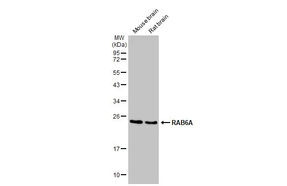 Various tissue extracts (50 μg) were separated by 12% SDS-PAGE, and the membrane was blotted with RAB6A antibody [HL1047] (GTX635981) diluted at 1:1000. The HRP-conjugated anti-rabbit IgG antibody (GTX213110-01) was used to detect the primary antibody.