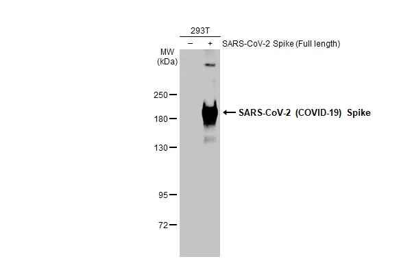 Non-transfected (–) and transfected (+) 293T whole cell extracts (30 μg) were separated by 5% SDS-PAGE, and the membrane was blotted with SARS-CoV-2 (COVID-19) Spike S2 antibody [GT745] (GTX636037) diluted at 1:1000000. The HRP-conjugated anti-mouse IgG antibody (GTX213111-01) was used to detect the primary antibody.