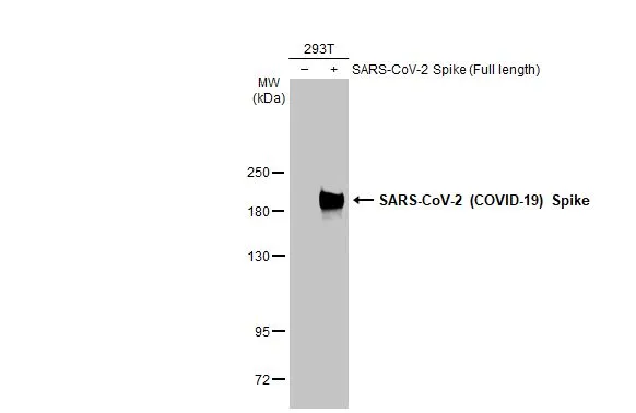 Non-transfected (–) and transfected (+) 293T whole cell extracts (30 μg) were separated by 5% SDS-PAGE, and the membrane was blotted with SARS-CoV-2 (COVID-19) Spike S2 antibody [GT8110] (GTX636038) diluted at 1:1000000. The HRP-conjugated anti-mouse IgG antibody (GTX213111-01) was used to detect the primary antibody.