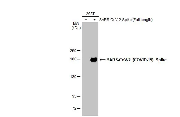 Non-transfected (-) and transfected (+) 293T whole cell extracts (30 microg) were separated by 5% SDS-PAGE, and the membrane was blotted with SARS-CoV-2 (COVID-19) Spike RBD antibody [GT5449] (GTX636042) diluted at 1:5000. The HRP-conjugated anti-mouse IgG antibody (GTX213111-01) was used to detect the primary antibody.