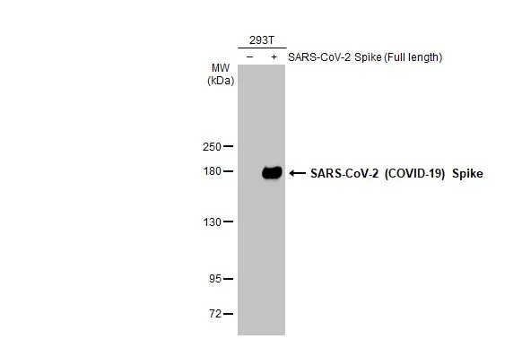 Non-transfected (–) and transfected (+) 293T whole cell extracts (30 μg) were separated by 5% SDS-PAGE, and the membrane was blotted with SARS-CoV-2 (COVID-19) Spike RBD antibody [GT5449] (GTX636042) diluted at 1:5000. The HRP-conjugated anti-mouse IgG antibody (GTX213111-01) was used to detect the primary antibody.