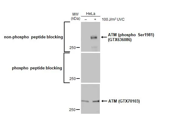Anti-ATM (phospho Ser1981) antibody [HL1062] (GTX636086