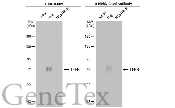 Various whole cell extracts (30 μg) were separated by 7.5% SDS-PAGE, and the membranes were blotted with TFEB antibody [HL1065] (GTX636089) diluted at 1:5000 and competitor's antibody (# Highly Cited Antibody) diluted at 1:1000. The HRP-conjugated anti-rabbit IgG antibody (GTX213110-01) was used to detect the primary antibody. *The competitor is not affiliated with GeneTex and does not endorse this product.