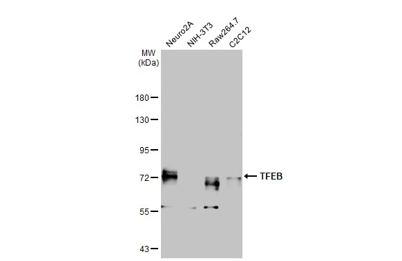 Various whole cell extracts (30 μg) were separated by 7.5% SDS-PAGE, and the membrane was blotted with TFEB antibody [HL1065] (GTX636089) diluted at 1:5000. The HRP-conjugated anti-rabbit IgG antibody (GTX213110-01) was used to detect the primary antibody.