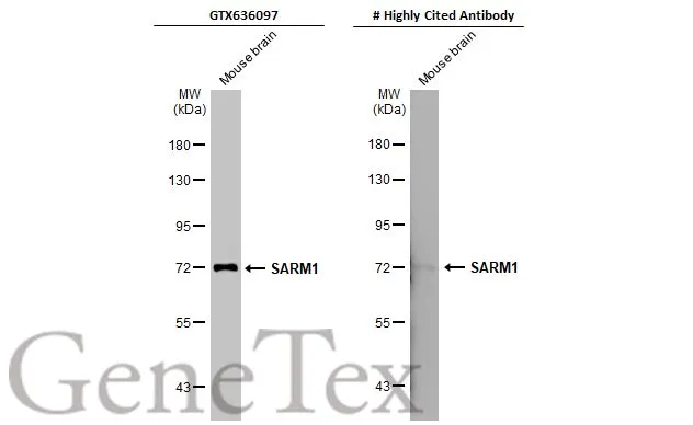 Anti-SARM1 antibody [HL1066] (GTX636097) | GeneTex