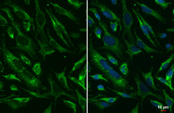 SDHA antibody [HL1067] detects SDHA protein at mitochondria by immunofluorescent analysis. Sample: HeLa cells were fixed in 4% paraformaldehyde at RT for 15 min. Green: SDHA stained by SDHA antibody [HL1067] (GTX636098) diluted at 1:500. Blue: Fluoroshield with DAPI (GTX30920).