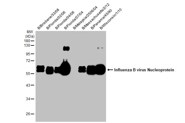 Influenza B viral lysates (1 microg) were separated by 10% SDS-PAGE, and the membrane was blotted with Influenza B virus Nucleoprotein antibody [HL1068] (GTX636099) diluted at 1:1000. The HRP-conjugated anti-rabbit IgG antibody (GTX213110-01) was used to detect the primary antibody.