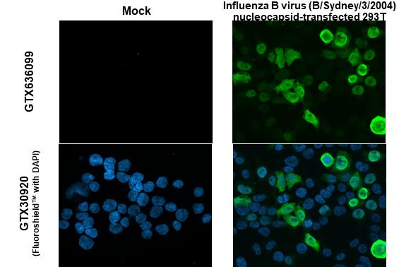 Influenza B virus Nucleoprotein antibody (GTX636099) detects overexpressed Influenza virus Nucleoprotein protein by immunofluorescent analysis. Sample: Mock and transfected 293T cells were fixed in 4% paraformaldehyde at RT for 15 min. Green: Influenza B virus Nucleoprotein stained by Influenza B virus Nucleoprotein antibody (GTX636099) diluted at 1:2000.