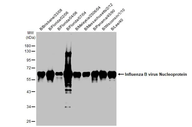 Influenza B viral lysates (1 microg) were separated by 10% SDS-PAGE, and the membrane was blotted with Influenza B virus Nucleoprotein antibody [HL1069] (GTX636100) diluted at 1:1000. The HRP-conjugated anti-rabbit IgG antibody (GTX213110-01) was used to detect the primary antibody.