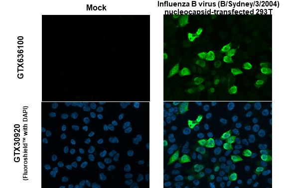 Influenza B virus Nucleoprotein antibody (GTX636100) detects overexpressed Influenza virus Nucleoprotein protein by immunofluorescent analysis. Sample: Mock and transfected 293T cells were fixed in 4% paraformaldehyde at RT for 15 min. Green: Influenza B virus Nucleoprotein stained by Influenza B virus Nucleoprotein antibody (GTX636100) diluted at 1:2000.