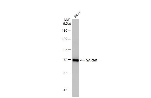 SARM1 antibody [HL1070]